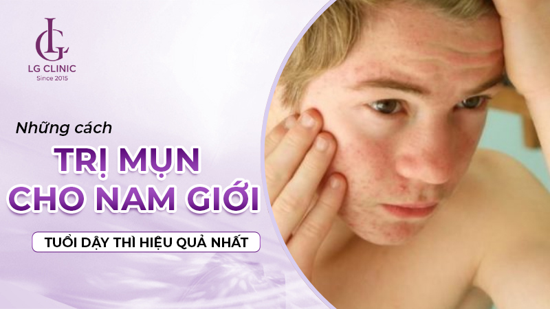 cách trị mụn cho nam giới tuổi dậy thì