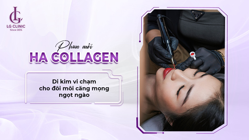 phun môi ha collagen