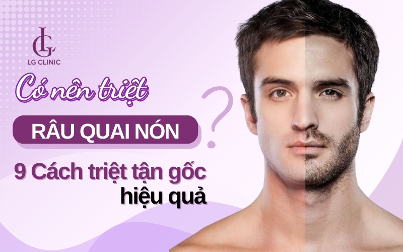 Râu quai nón nam giới