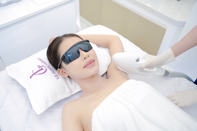 Hạn chế thâm nách bằng phương pháp laser