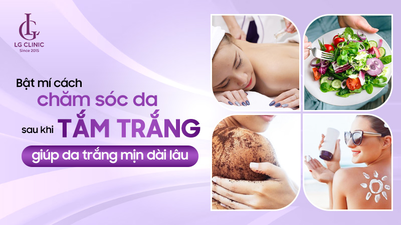Chăm sóc da sau khi tắm trắng