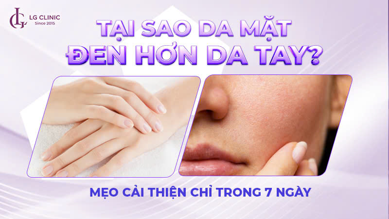 Tại sao da mặt đen hơn da tay