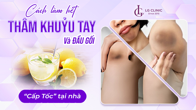Cách làm hết thâm khuỷu tay và đầu gối