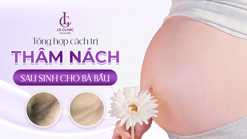 Cách trị thâm nách sau sinh