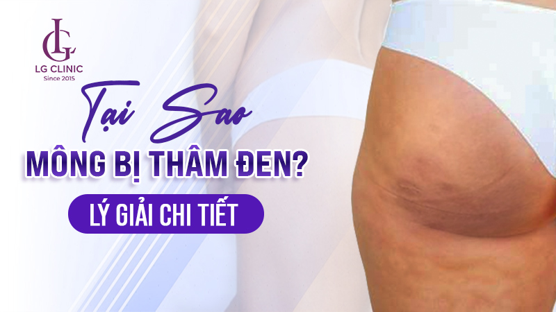 tại sao mông bị thâm đen