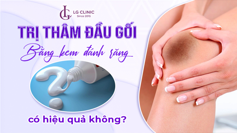 cách trị thâm đầu gối bằng kem đánh răng