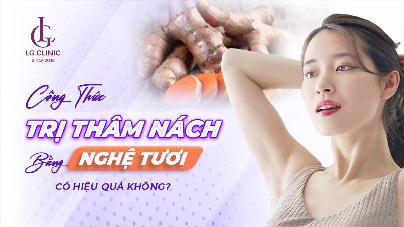 xóa thâm nách bằng Nghệ tươi