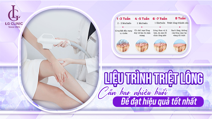 Liệu trình triệt lông cần bao nhiêu buổi