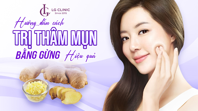 trị thâm mụn bằng gừng tại nhà