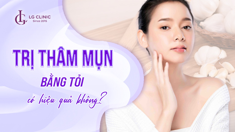 Trị thâm mụn bằng tỏi