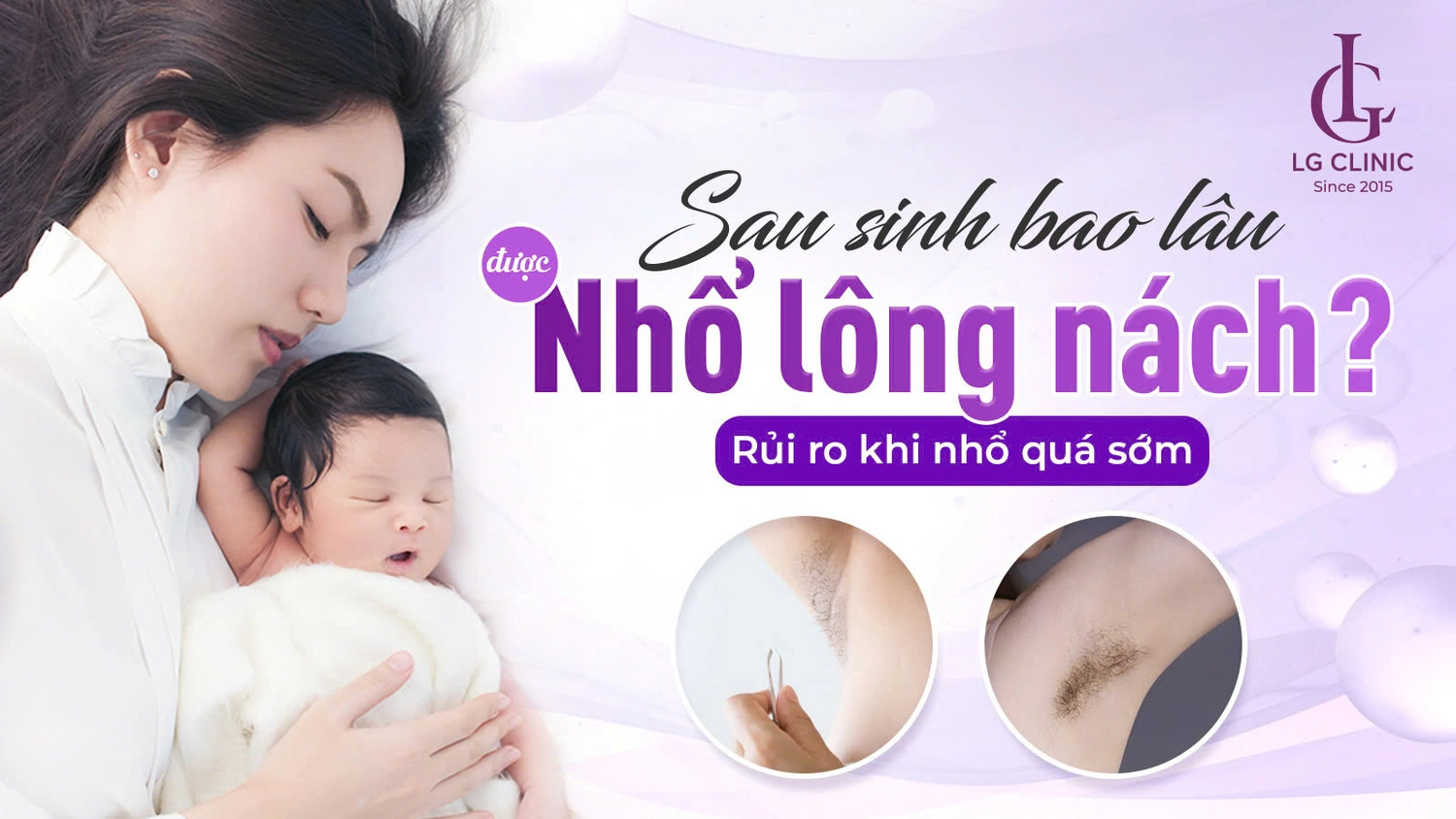 Sau sinh bao lâu được nhổ lông nách