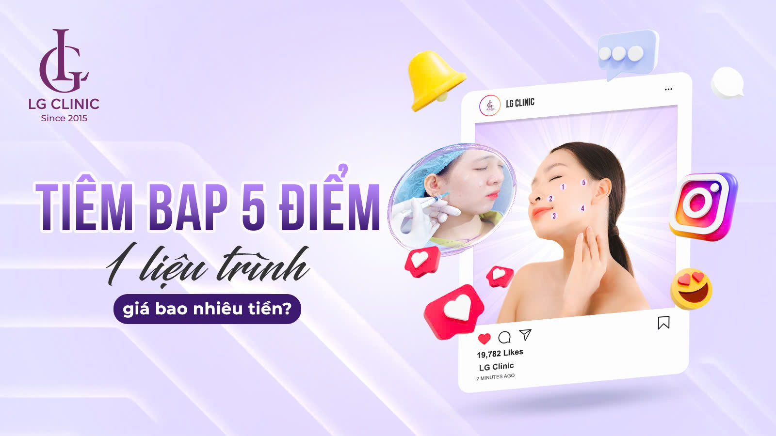 tiêm bap 5 điểm