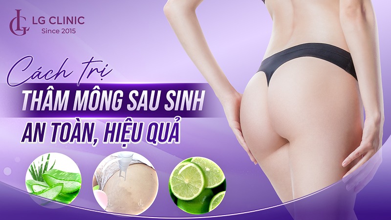 cách trị thâm mông sau sinh
