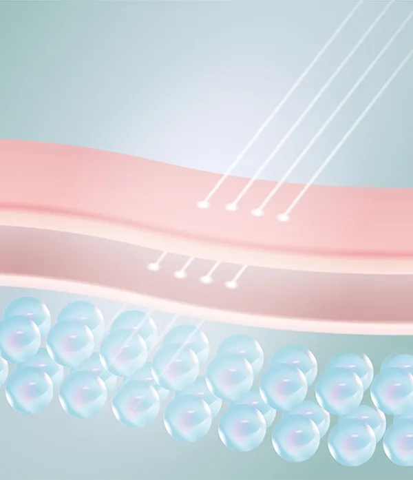 Laser vi điểm