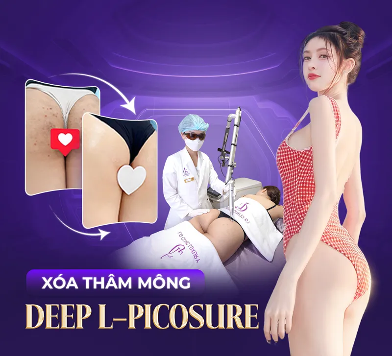 Banner xóa thâm mông