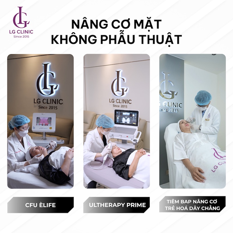 nâng cơ mặt không phẫu thuật