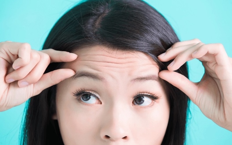nếp nhăn trên trán