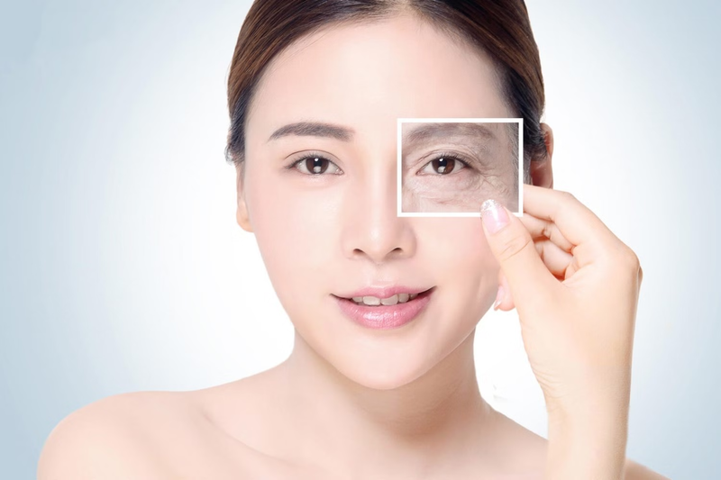 nếp nhăn vùng mắt