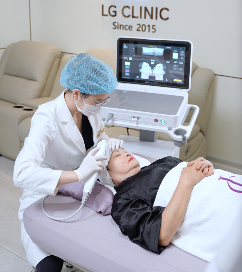 công nghệ Ultherapy xoá vết chân chim