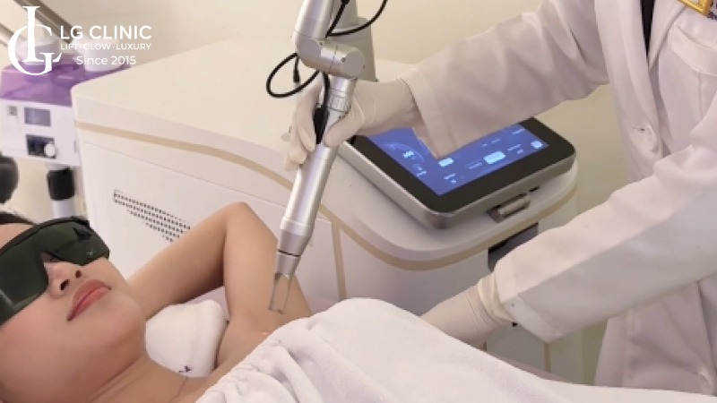 trị thâm nách mất bao lâu