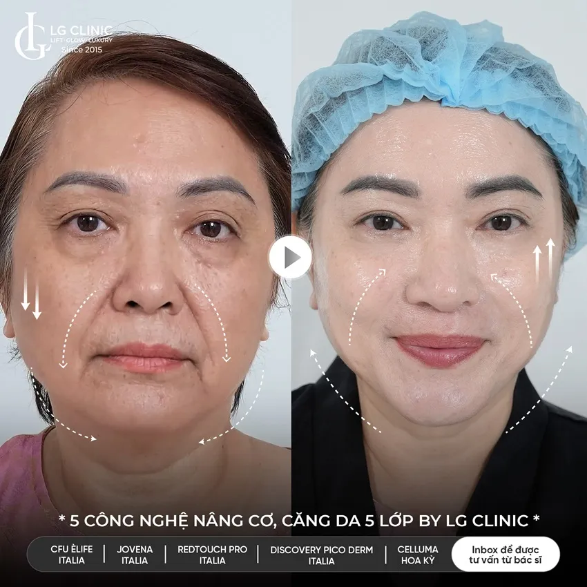 Hình ảnh ba 5510