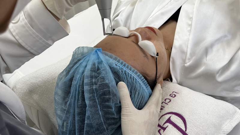 laser pico có bỏng da không